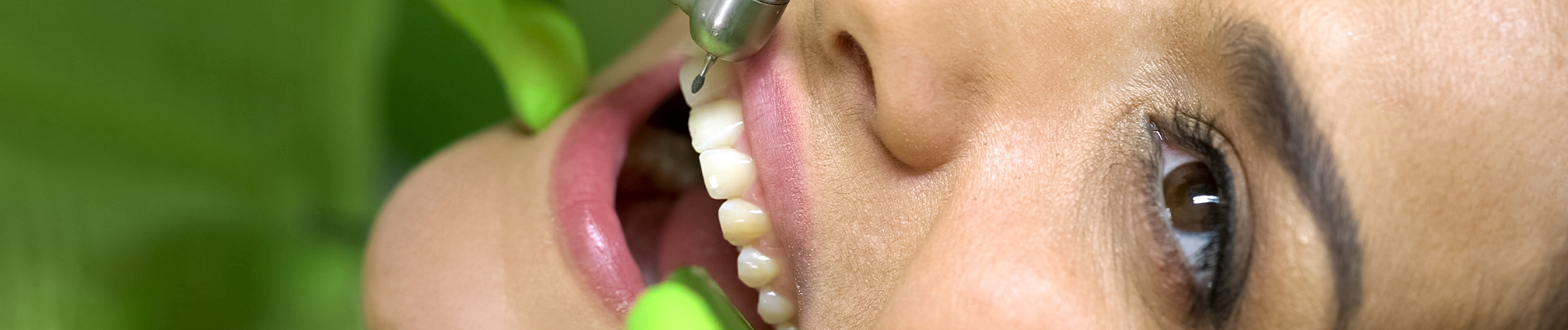 Chipped a Front Tooth? Here are Your Options