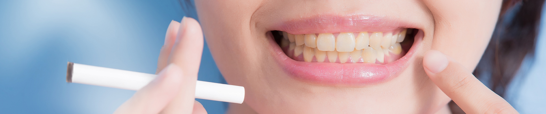 The Impact of Smoking on Dental Emergencies - General Info article