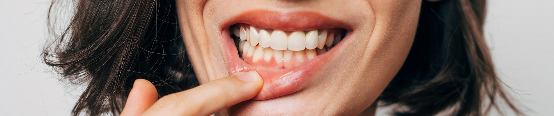 Why Do My Gums Bleed? Gingivitis Explained